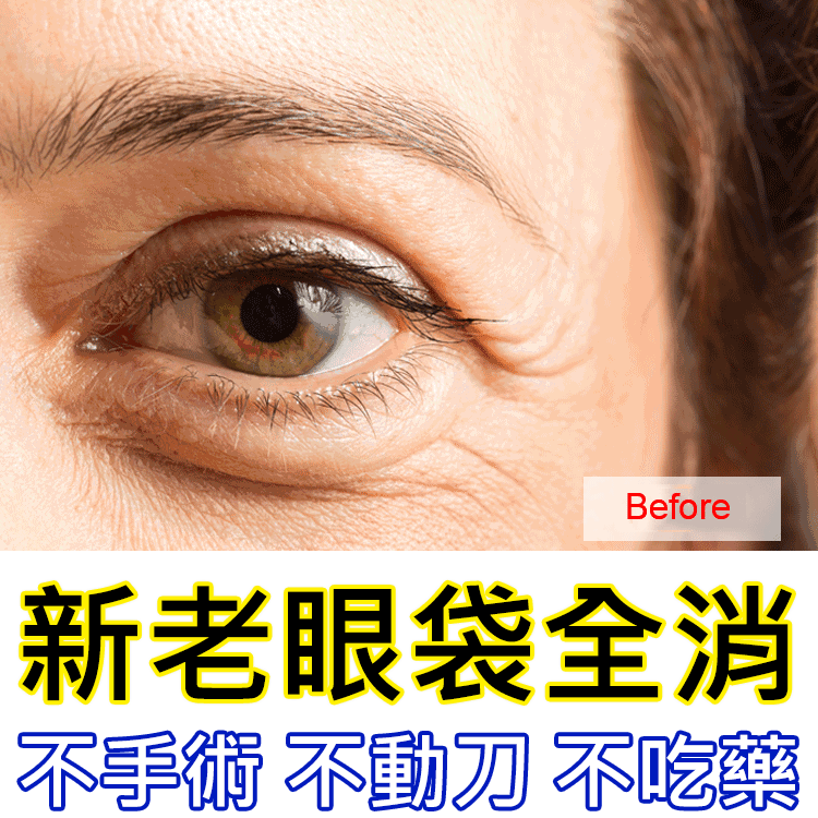 【歐洲皇室的保養秘訣】奢華貴婦黃金眼膜