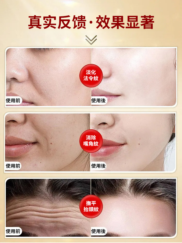 仲夏青春小紅罐抗皺緊緻乳霜