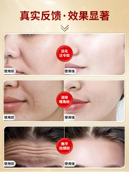 仲夏青春小紅罐抗皺緊緻乳霜