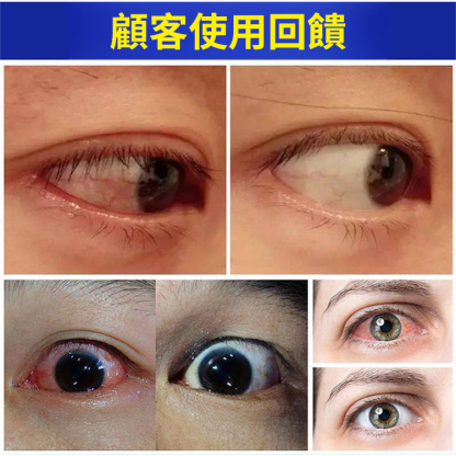 熊膽雪蓮葉黃素明目眼藥水