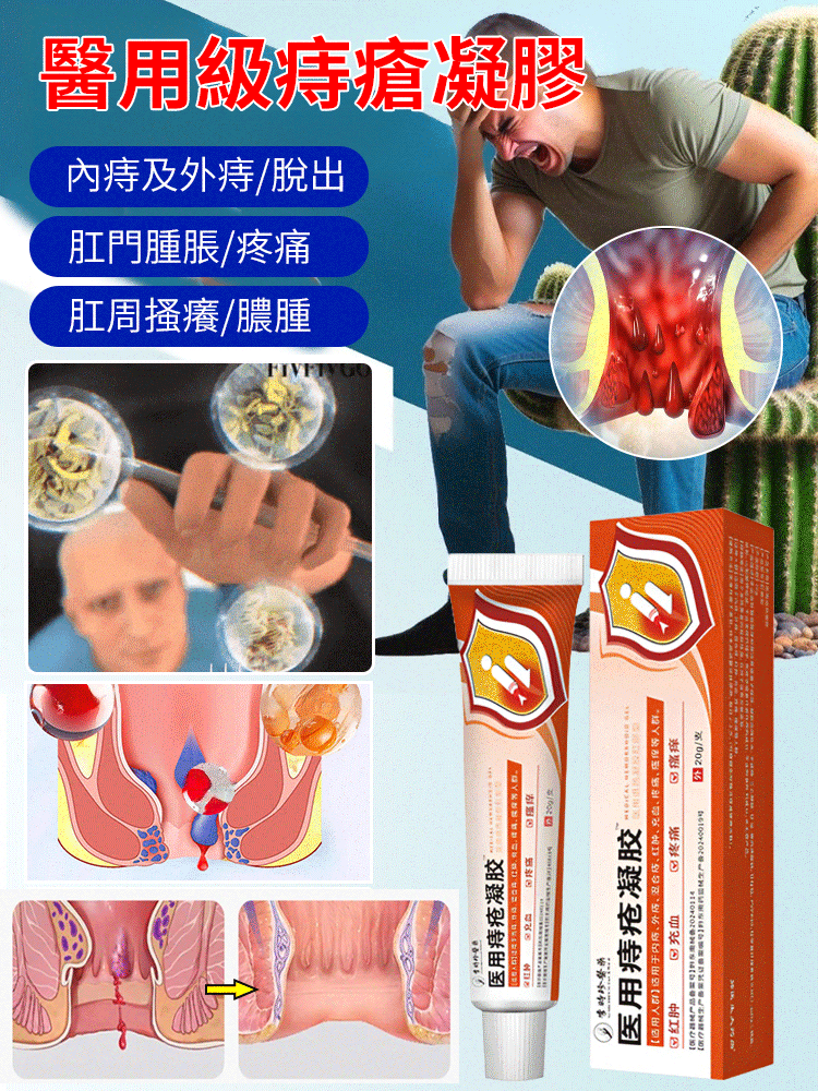 醫用痔瘡凝膠