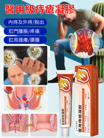 醫用痔瘡凝膠