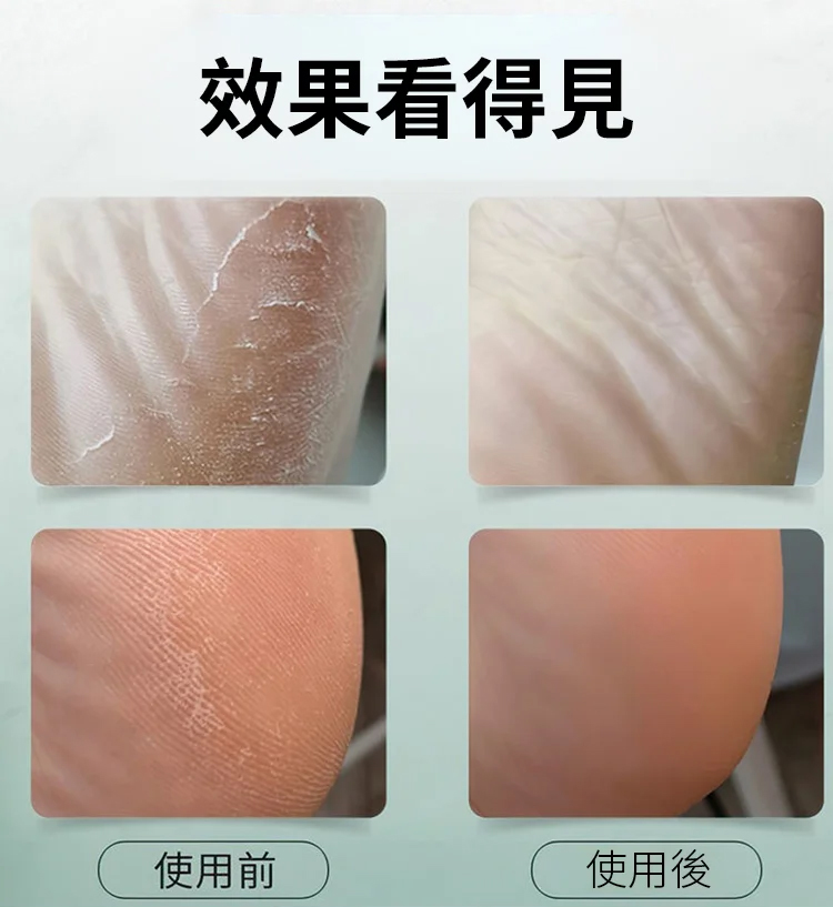 【10秒修腳】電動磨腳器-三頭替換