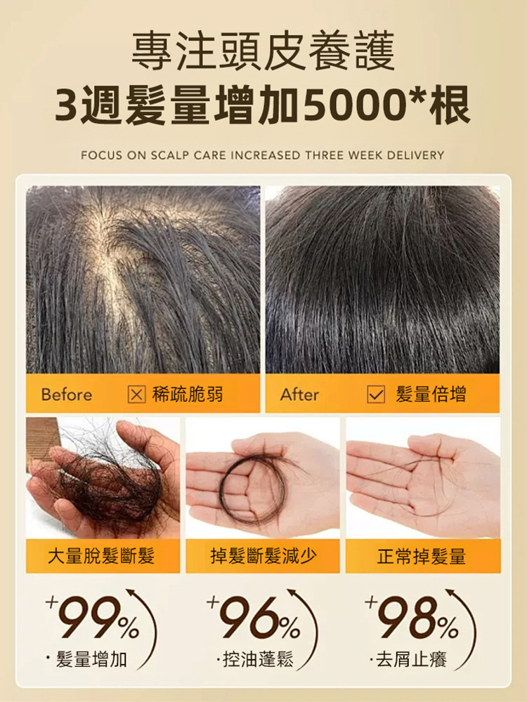 防脫育髪強韌髮根滾珠精華