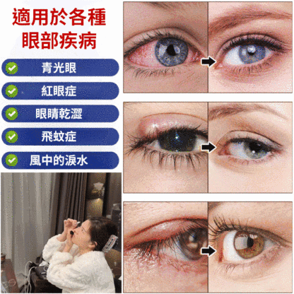 【消除所有不適】葉黃素眼藥水