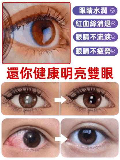 黑加侖藍莓葉黃素酯片葉
