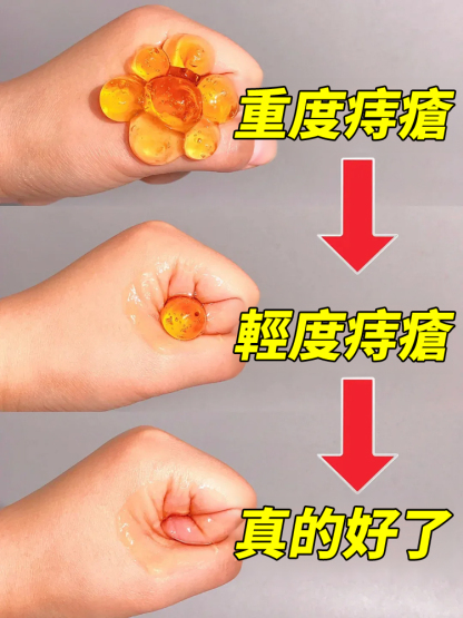 醫用痔瘡凝膠