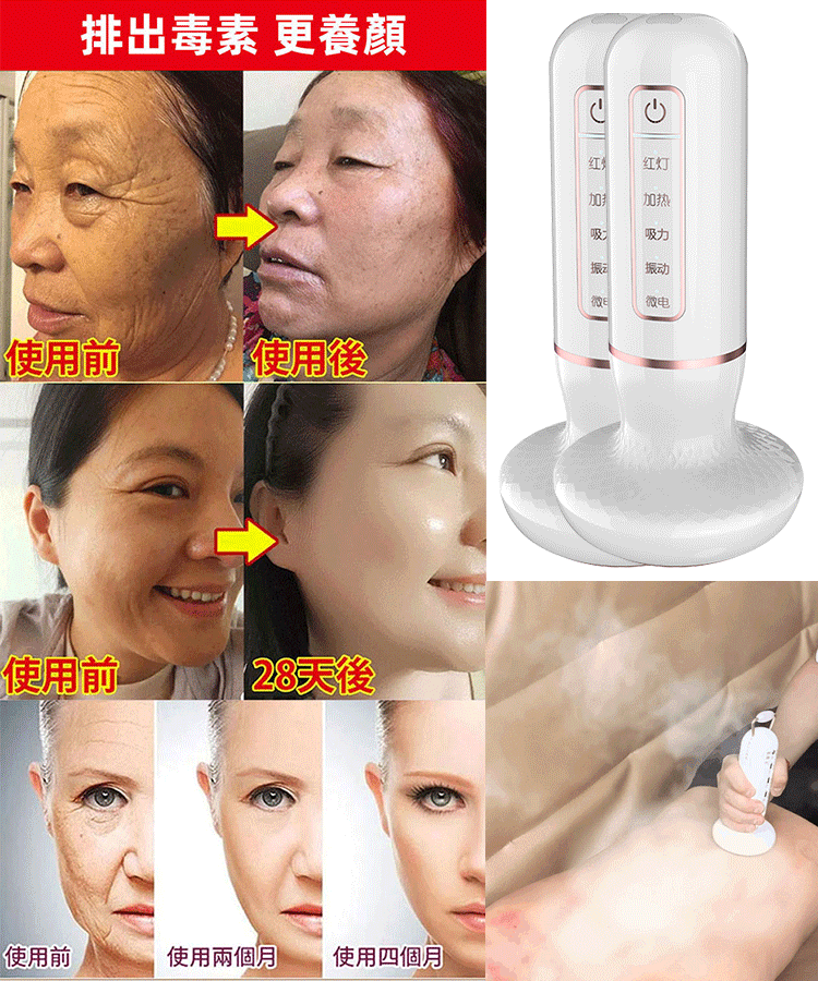 【智慧按摩】AI智慧電動刮痧儀