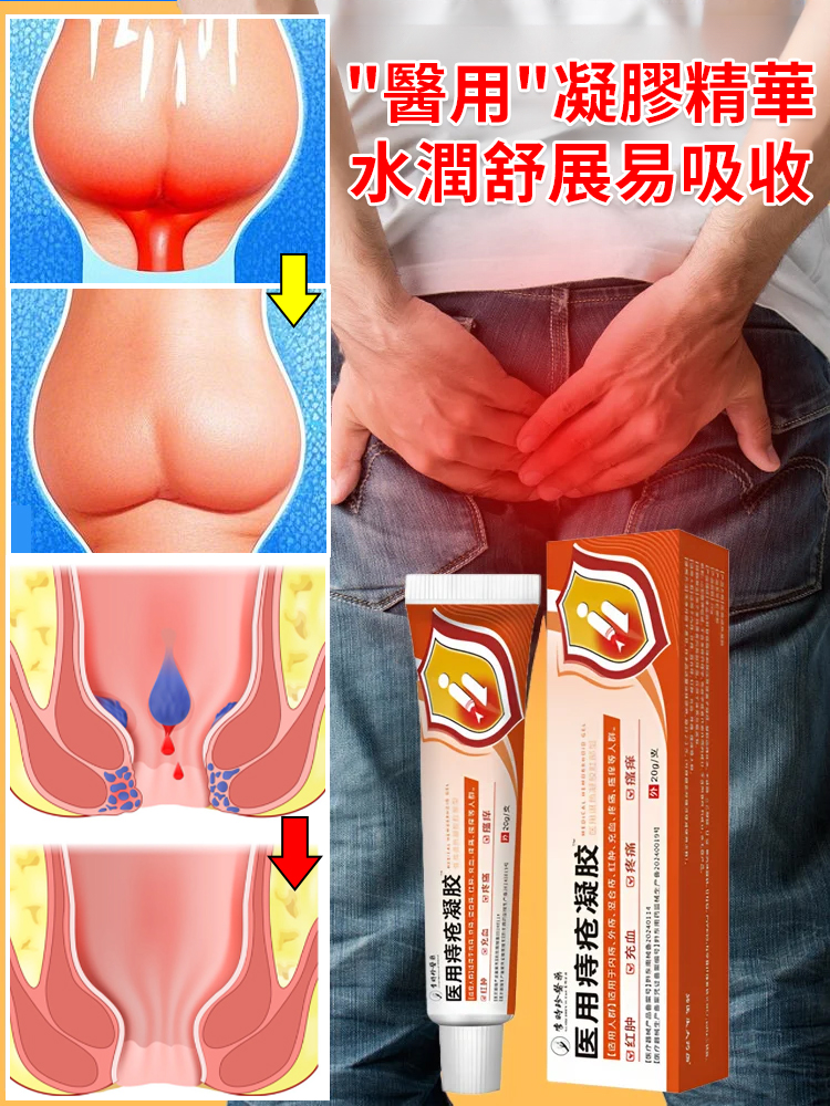 醫用痔瘡凝膠