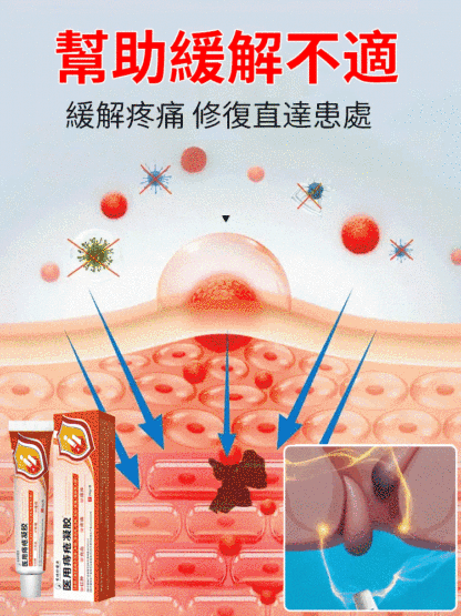醫用痔瘡凝膠