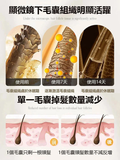 防脫育髪強韌髮根滾珠精華