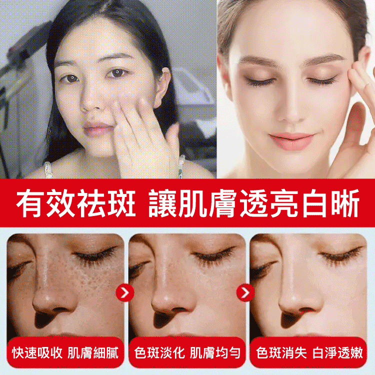 377美白淡斑霜