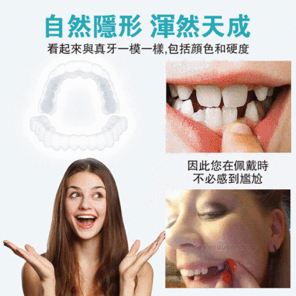 可調節卡扣式假牙