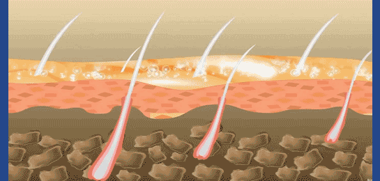 未标题-1_15.gif
