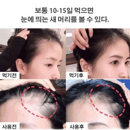 호두 오디 흑임자환 