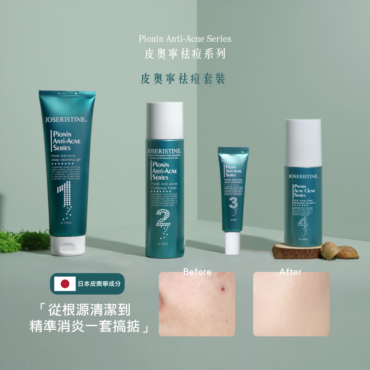 皮奧寧祛痘套裝