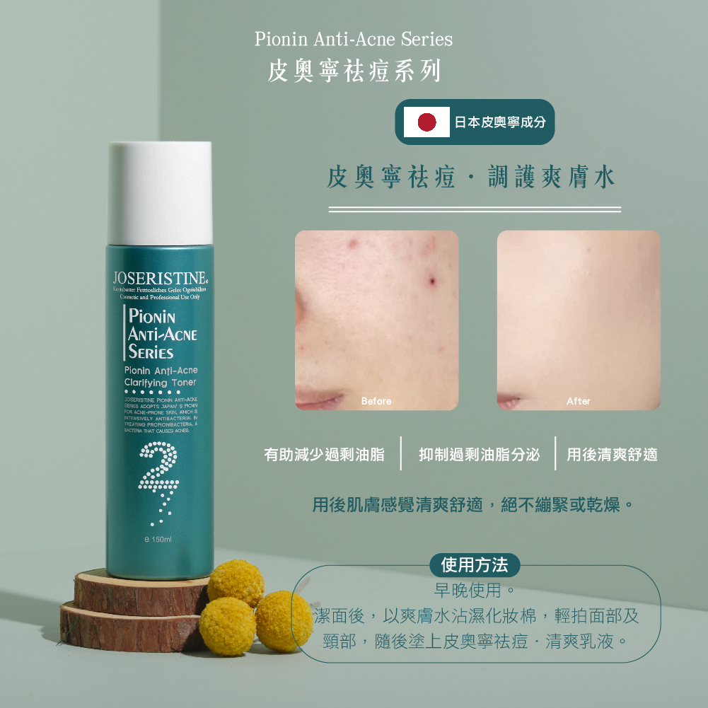 皮奧寧祛痘．調護爽膚水