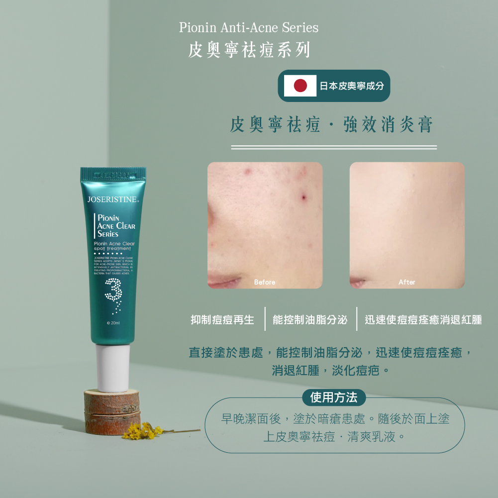 皮奧寧祛痘．強效消炎膏