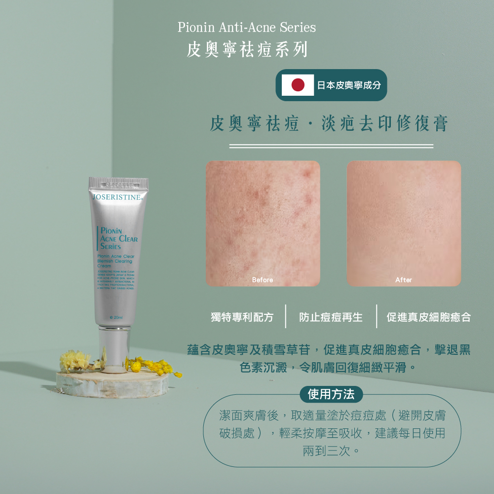 皮奧寧祛痘．淡疤去印修復膏