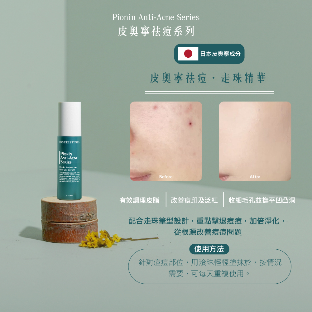 皮奧寧祛痘．走珠精華