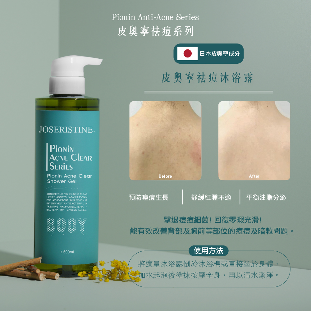 皮奧寧祛痘沐浴露
