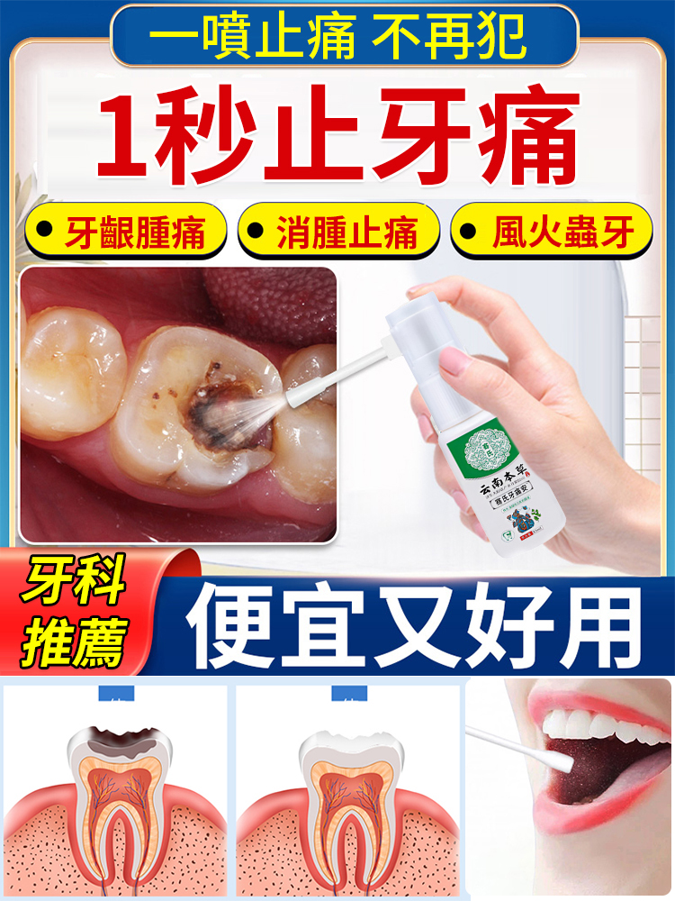 牙痛寧草本抑菌噴劑