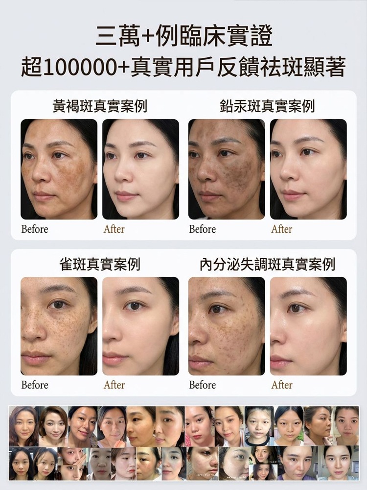 【消除歲月痕跡】美白祛斑修護霜