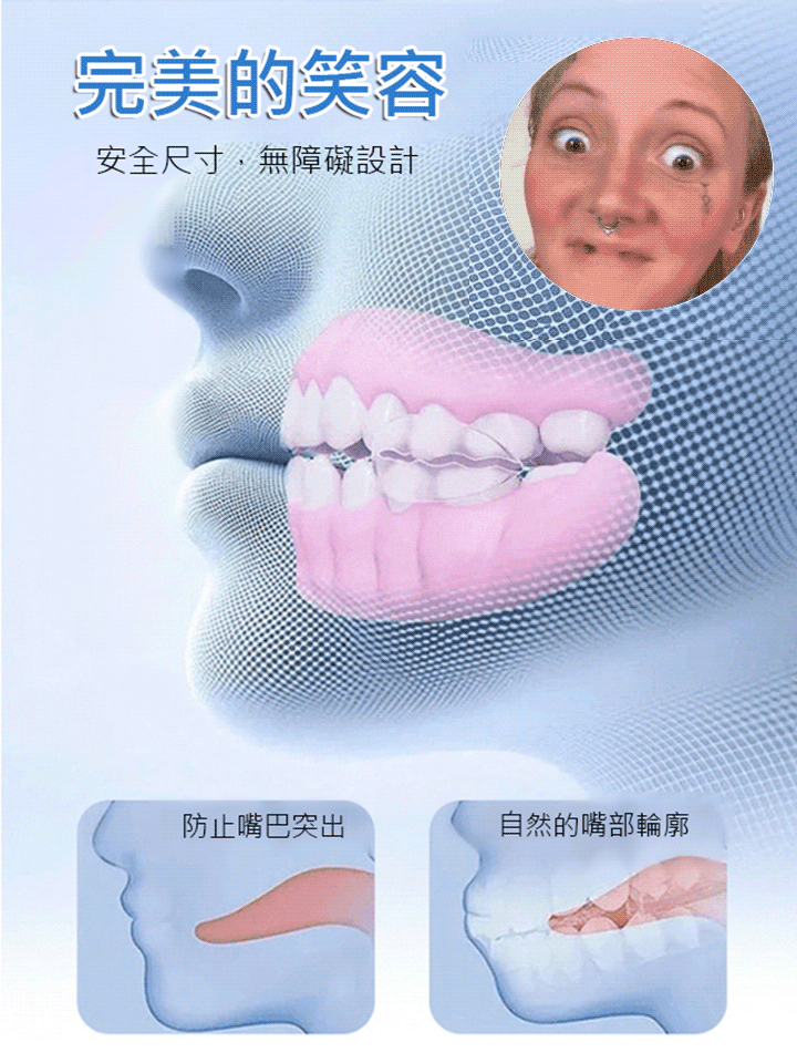 功能性全口假牙修飾套裝 