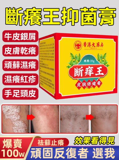斷癢王抑菌膏
