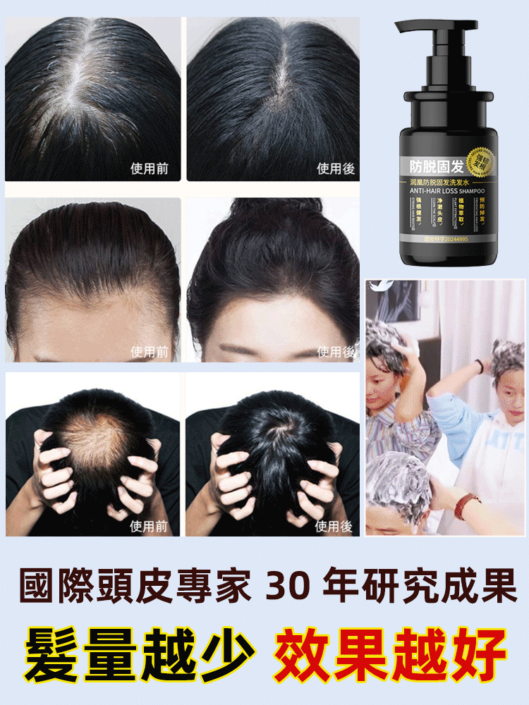 【掉髮救星】草本防脫固髮洗髮水，台北育發醫師推薦，解決你的掉髮困擾，幾十種草本精華，搭配專研生髮因子