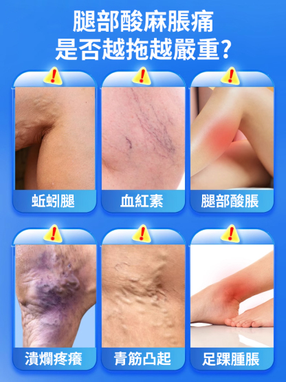 靜脈非曲張冷敷凝膠
