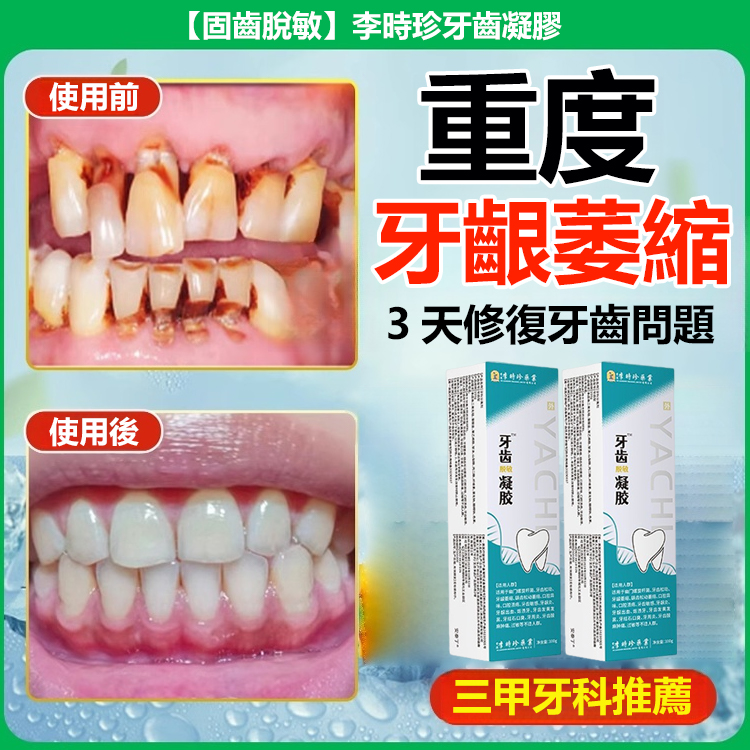 【固齒脫敏】李時珍牙齒凝膠-送貨上門，0購物風險