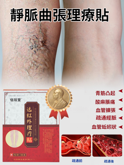 靜脈曲張貼穴位遠紅外線理療貼
