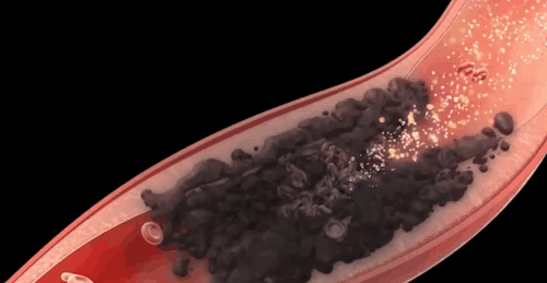 20bc8fa74b843e87a6bbaf84a5795dce.gif