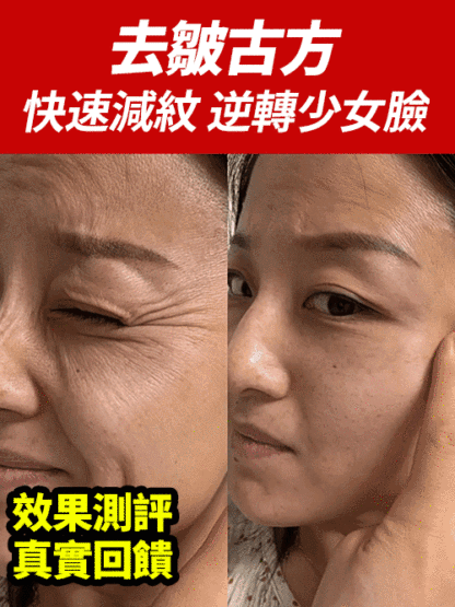 【7天淡紋，0元試用】草本黃耆霜