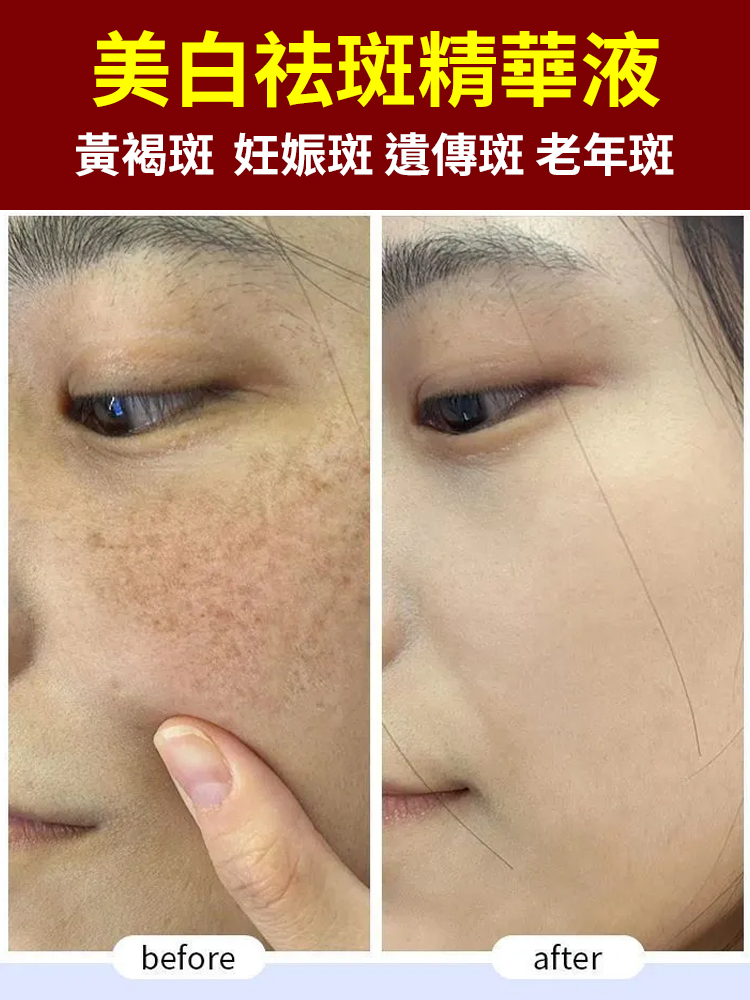 【一抹祛斑美白】提亮膚色精華液-醫學級配方,7 天見證色斑淡化、去黃提亮年輕10歲