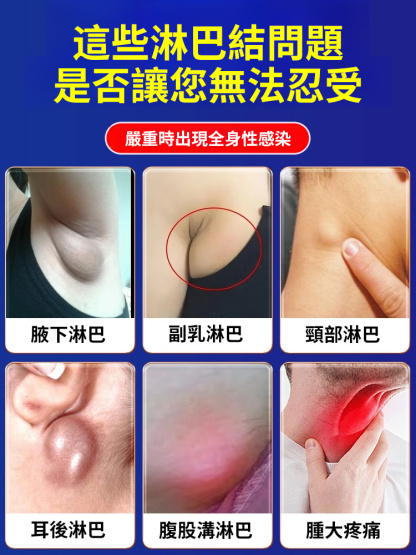 淋巴結消散保健膏