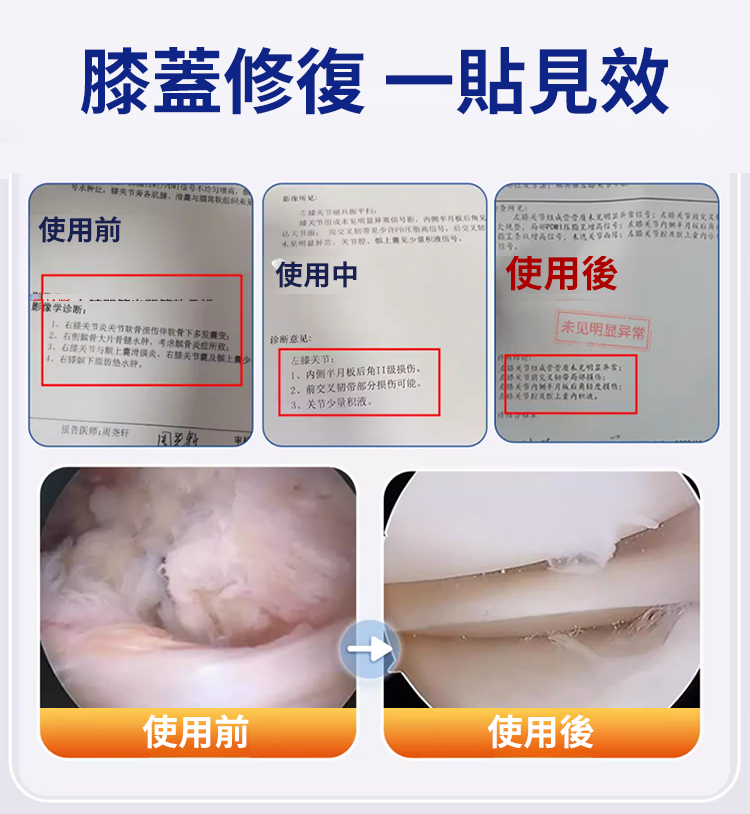 翻译件-SL-涩冈膝盖关节贴膏止痛型滑膜炎-1238118-系统_12.png