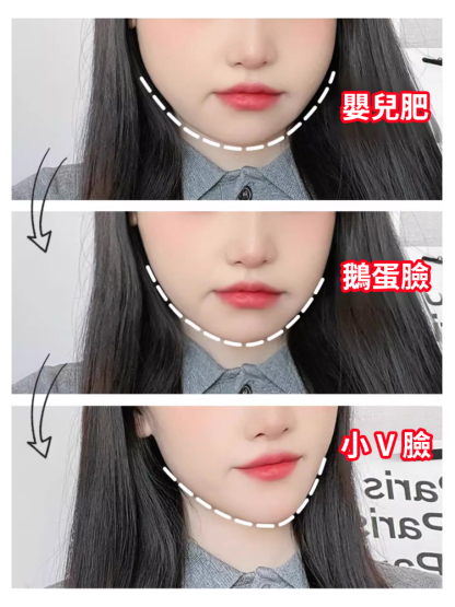【1週小V臉】瘦臉塑型高頻瘦臉儀，按摩脸部紧致提拉,每天15分钟，还你瓜子脸，享受按摩的同时还能瘦脸