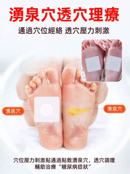 專業降血糖化糖消穴位貼，一帖舒緩降糖兩貼吃喝不愁，不打針不吃藥，堅持貼每天貼