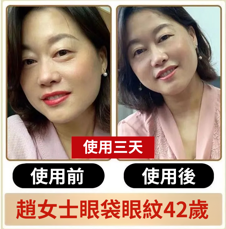 翻译件-SL-眼部黄芪精华抗皱眼部抗皱精华油-1240992-系统_11.png
