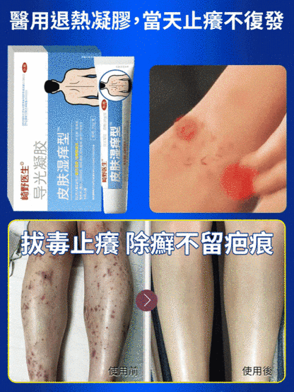 皮膚濕癢型醫用退燒凝膠