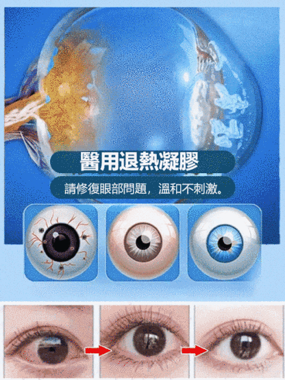 潤目型醫用退燒凝膠