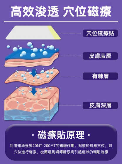 【不打針不吃藥】醫用糖尿病降糖穴位磁療貼