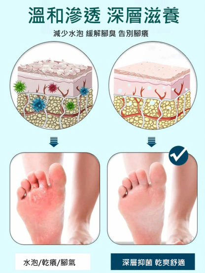 【兩週去腳氣】草本植物腳部抑菌噴霧，草本精粹成分，殺菌抑菌，穿襪子穿鞋前噴兩下，讓你雙腳不再癢，告別大漢腳