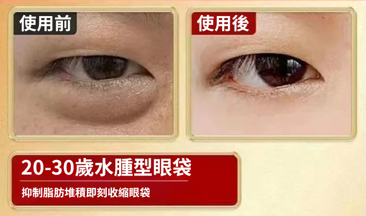 翻译件-SL-眼部黄芪精华抗皱眼部抗皱精华油-1240992-系统_13.png
