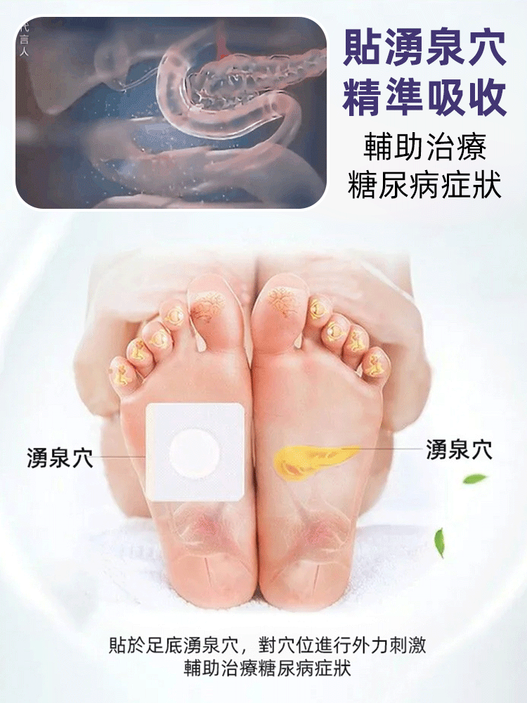 【不打針不吃藥】醫用糖尿病降糖穴位磁療貼