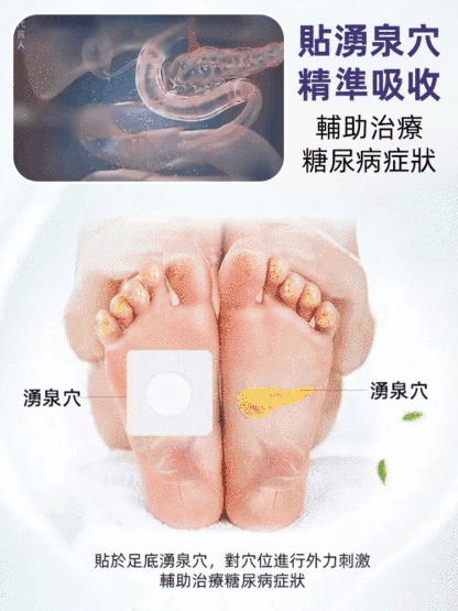 【不打針不吃藥】醫用糖尿病降糖穴位磁療貼