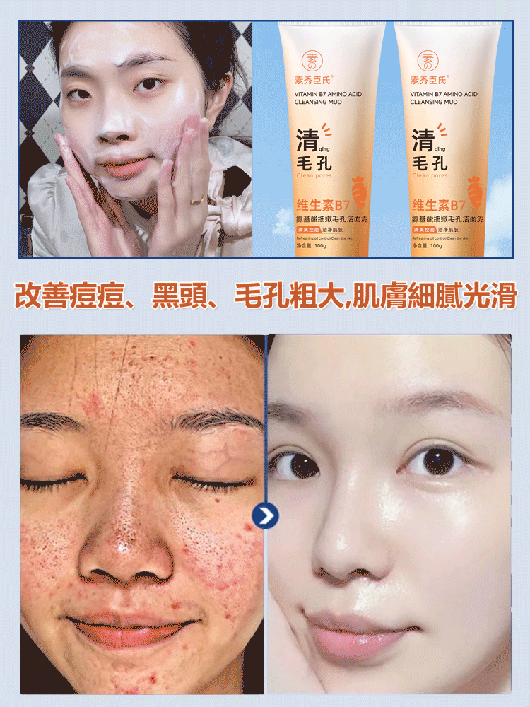 維生素B7氨基酸毛孔清潔潔面泥這清潔效果太猛了！洗掉毛孔痘痘，還你光滑肌膚，毛孔粗大黑頭油脂痘痘全部清掉