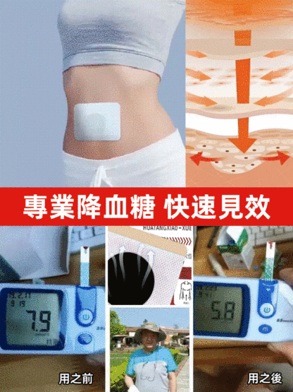 專業降血糖化糖消穴位貼，一帖舒緩降糖兩貼吃喝不愁，不打針不吃藥，堅持貼每天貼